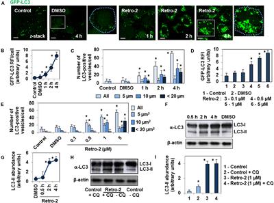 Small Trafficking Inhibitor Retro-2 Disrupts the Microtubule-Dependent Trafficking of Autophagic Vacuoles